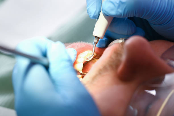 Best Emergency Broken Tooth Repair in River Forest, IL